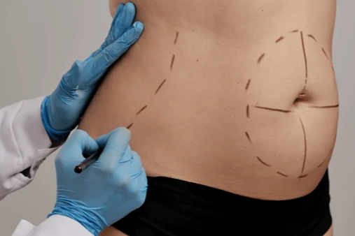 Plastic & Reconstructive surgery